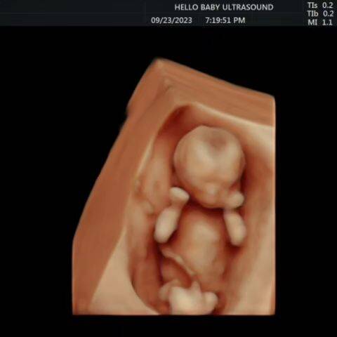 Hello Baby 3D